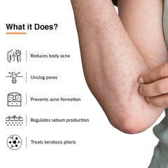 Fixderma Salyzap Body Spray 50ml