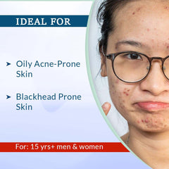 Fixderma Alpha Beta Acne Gel 30ml