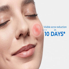 D Acne Foaming Face Wash, 60ml