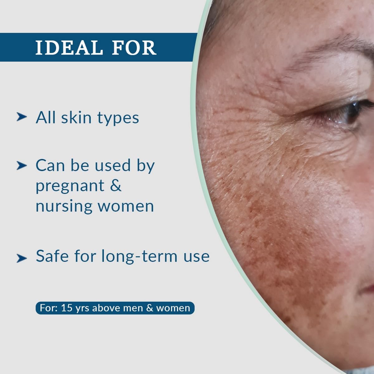 Fixderma Aha Lightening Gel 30ml