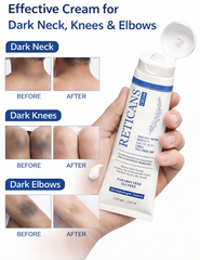 Reticans Cream 100gm| A Specialized Formulation to Treat Acanthosis Nigricans.