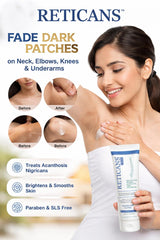 Reticans Cream 100gm| A Specialized Formulation to Treat Acanthosis Nigricans.