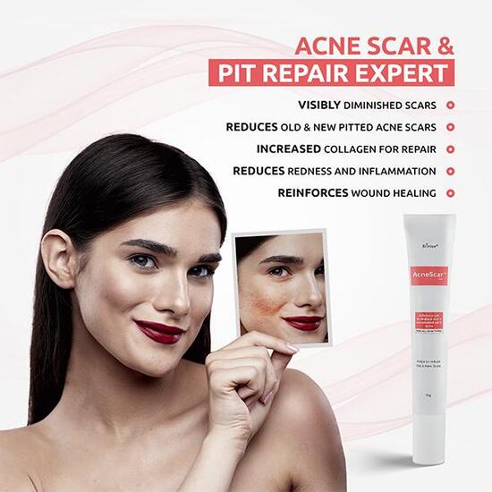 AcneScar Gel, 15gm